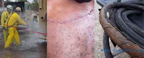 高壓（yā）清洗機（jī）工作中應注（zhù）意的安全問題